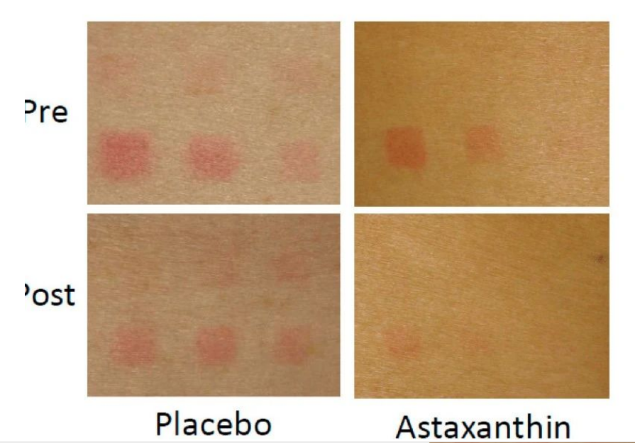 艾詩特蝦青素 艾詩特蝦青素