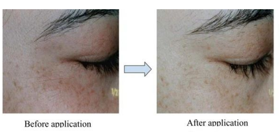 艾詩特蝦青素 艾詩特蝦青素