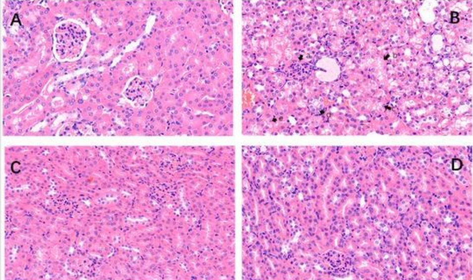 艾詩(shī)特蝦青素 艾詩(shī)特蝦青素
