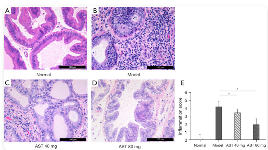 艾詩特蝦青素 艾詩特蝦青素