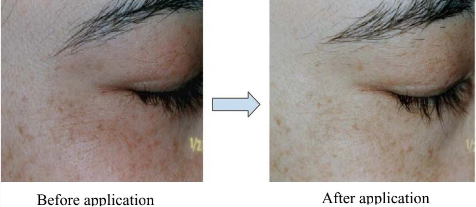 艾詩(shī)特蝦青素