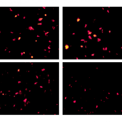 天然蝦青素抗血栓的藥理學(xué)機(jī)制研究
