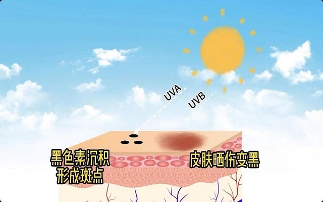 天然蝦青素可以祛斑嗎？